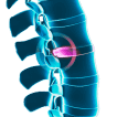 HealYourBulgingDisc.com