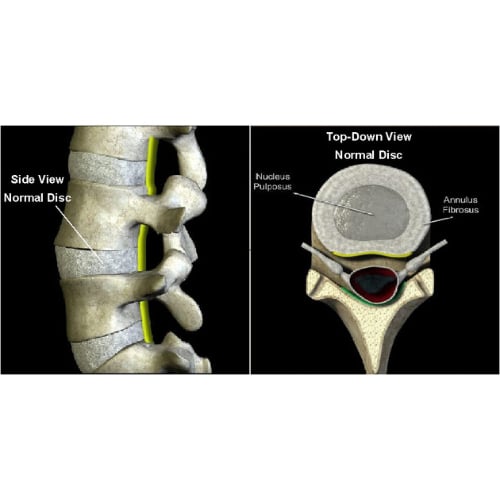 The human spine, vertebrae and spinal discs